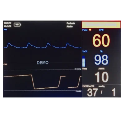 Monitor MA507 Oxicapnógrafo (SpO₂ + CO₂)