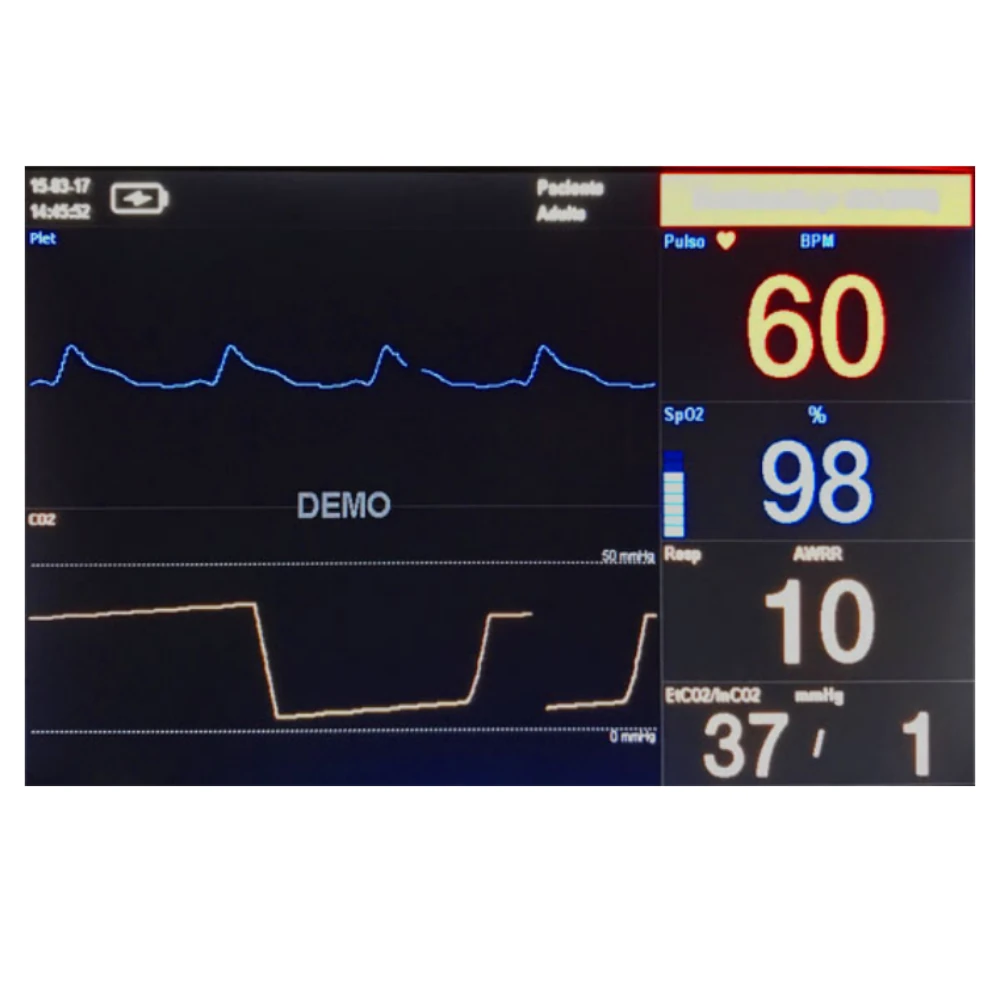 Monitor multiparamétrico MA507 Oxicapnógrafo (SpO₂ + CO₂)-2