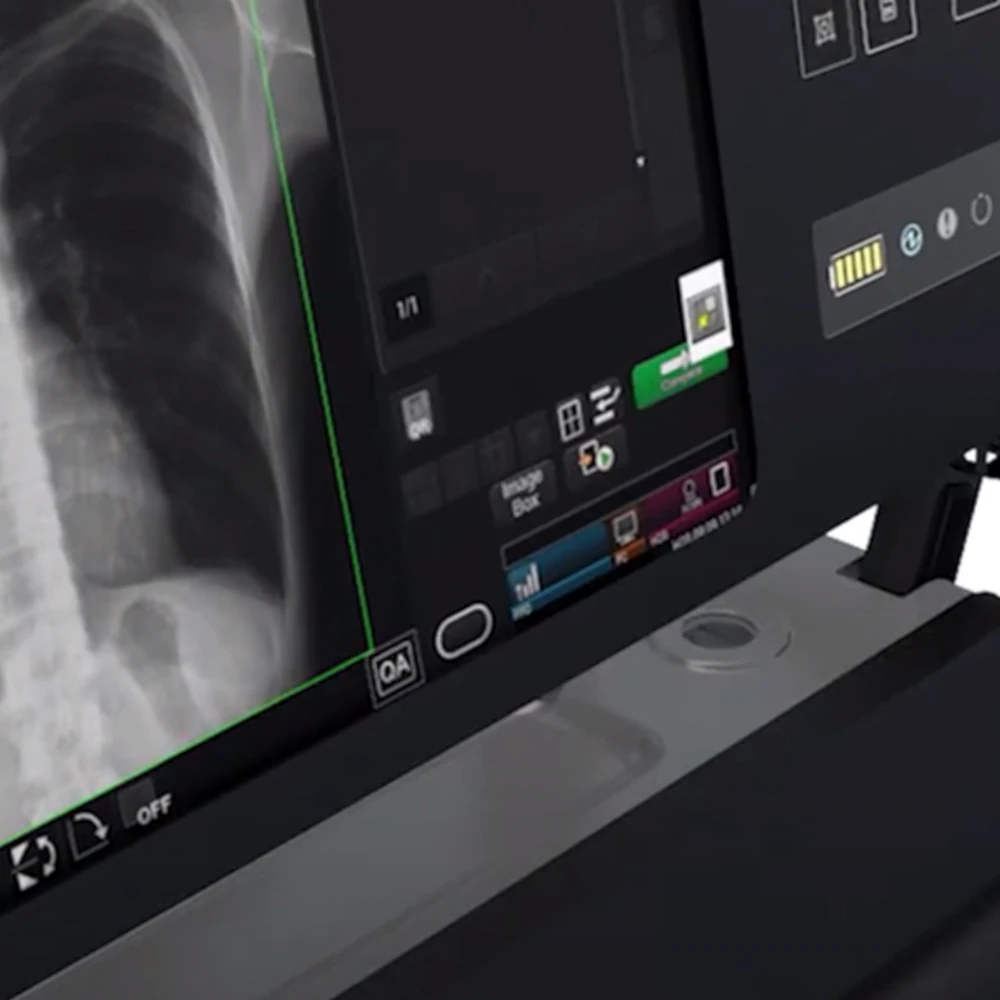 Equipo de rx fujifilm nano vista pantalla